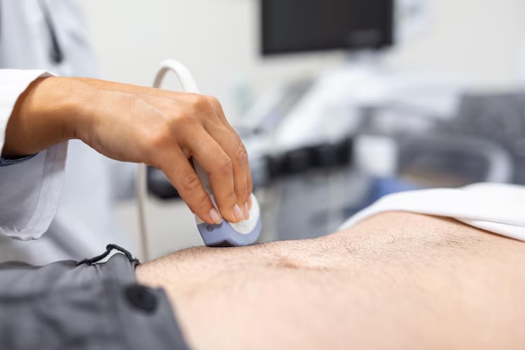 Kidney Biopsy------23
